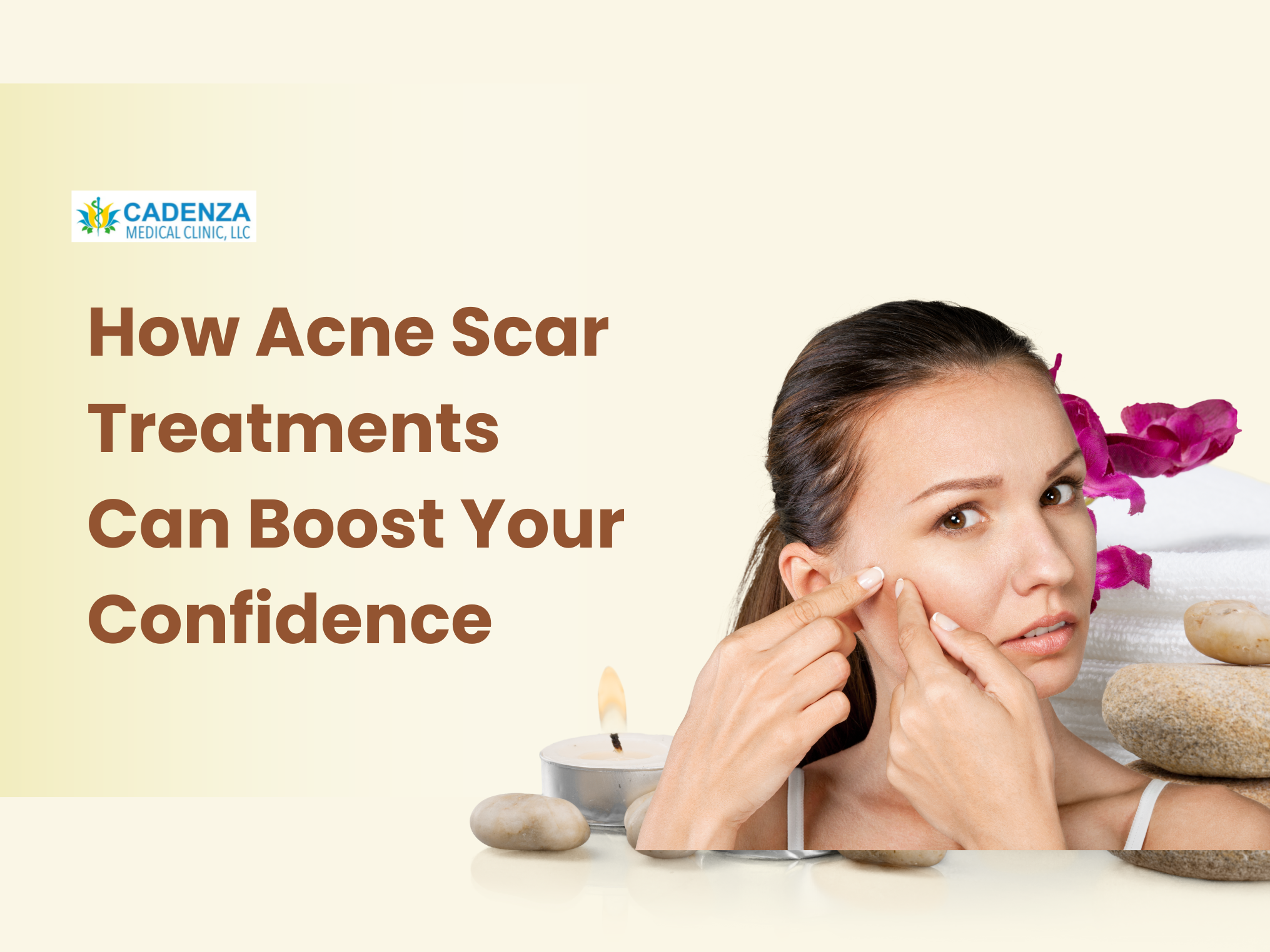 How Acne Scar Treatments Can Boost Your Confidence