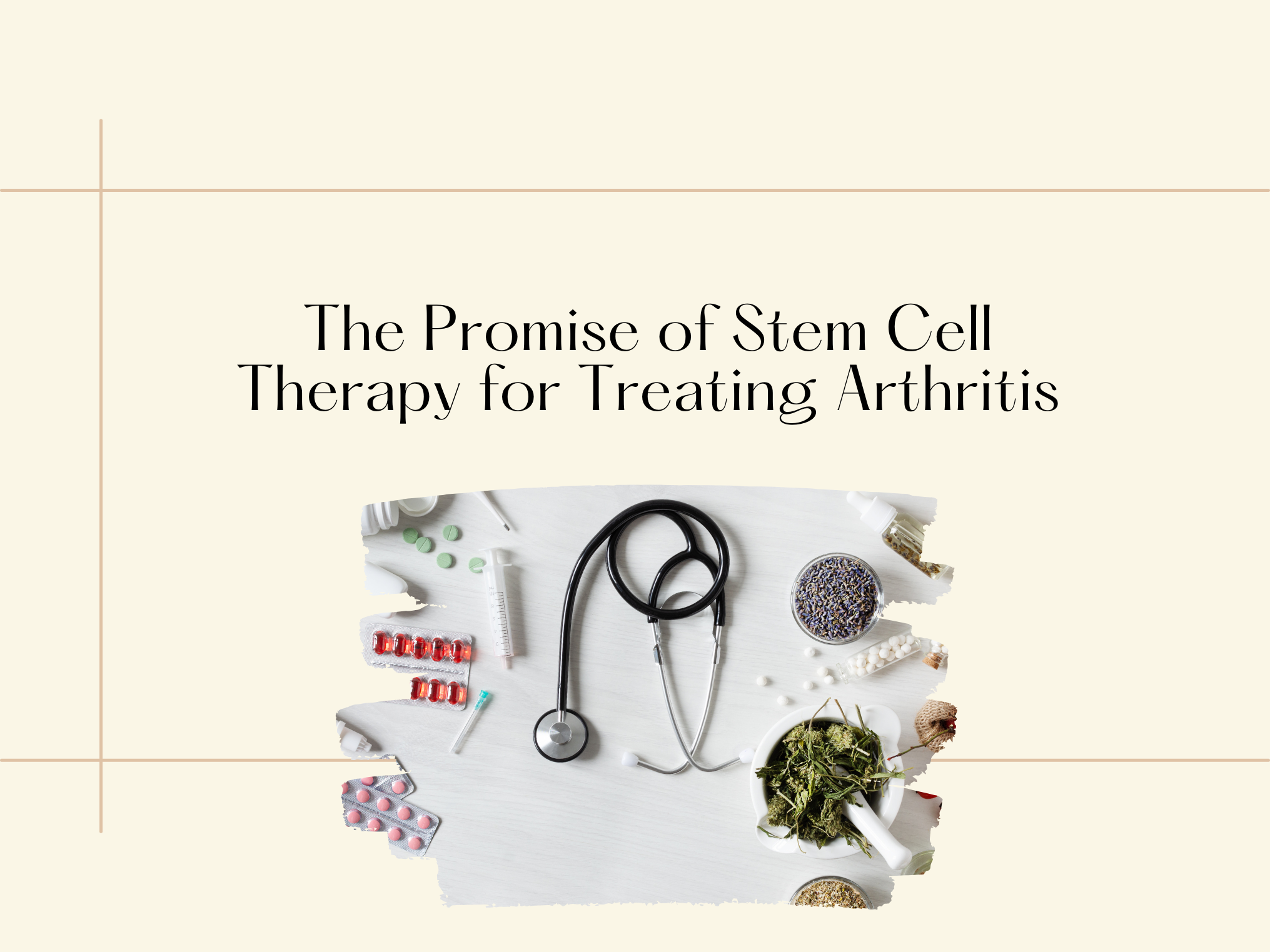 The Promise of Stem Cell Therapy for Treating Arthritis